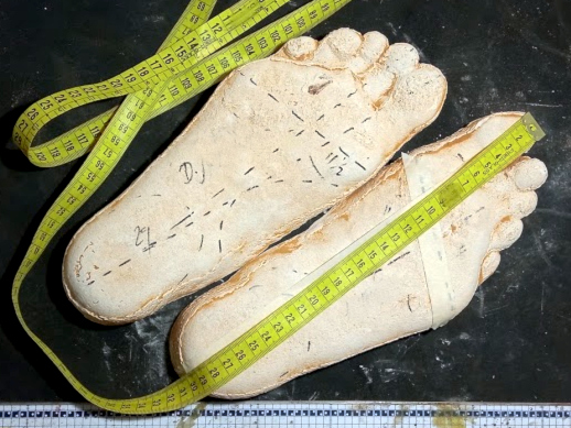 Moulages en plâtre des pieds en cours de mesure et d’étude